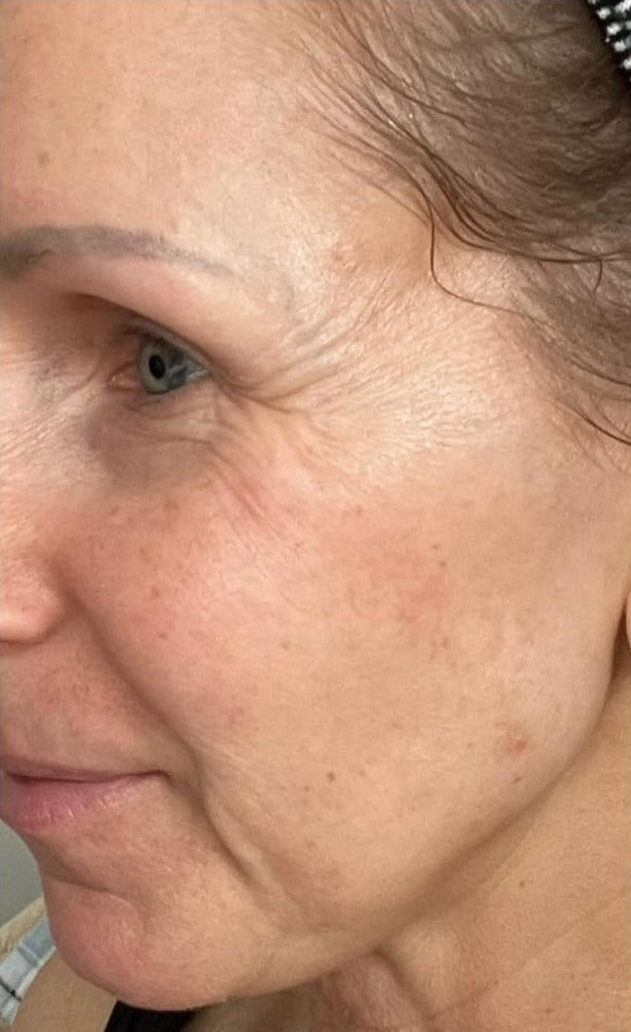 Close-up of a person's face with visible skin texture and expression.