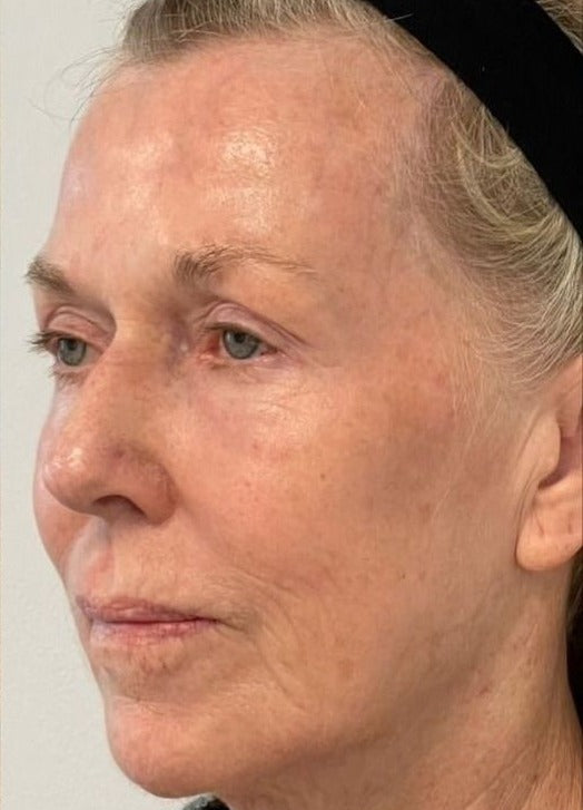 Close-up of a person's face with a neutral expression on a plain background